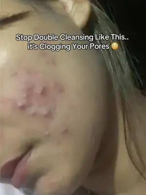 Double cleansing = the first step to actually clean skin โค๏ธ #mixsoon #amazonfinds #amazonprime #cleansingoil #doublecleansing @mixsoon