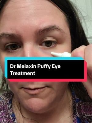 trying a new eye cream by Dr Melaxin #puffyeyes #flawless #flawlessskin #skincare #skincareroutine #skincaretips #flawlessskin #antiaging #wrinkles #finelines #skincarerecommendations #skincarereviews #honestreview #darkcircles #darkcirclesundereyes #tiktokshopholidayhaul #holidayhaul #tiktokshopdeals #christmasgifts #christmasgiftideas #valentinegift #giftsforher