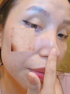 Perfect Pore Set ! Elimina los poros abiertos con @SKIN1004 US los puntos negros. . . #SKIN1004 #tiktokshopcreatorpick