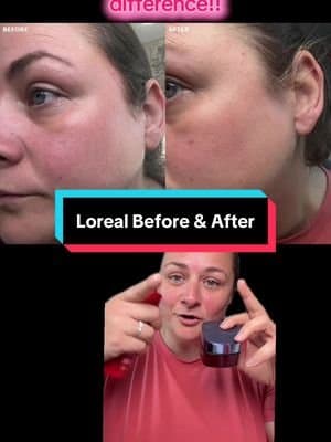 I’m so please with my results within such a short period of time x @L'Oréal Paris UK #tiktokmademebuyit #skincare #loreal #dealdrops #beauty