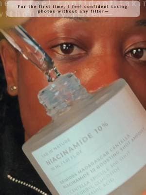 @SKIN1004 US Niacinamide 10 Boosting shot ampoule Clearer, brighter skin with 10% Niacinamide + Tranexamic Acid + Vitamin C ✨ This Centella spicule brightening ampoule helps fade dark spots, PIE, and uneven skin tone while staying hydrating and gentle for sensitive skin. 300 Madagascar Centella spicules help active ingredients absorb deeper for faster results. How I use it: 2–3 drops after cleansing → massage → moisturizer. Start 2–3x a week, then increase. SPF in the morning! Available on the tiktok shop #SKIN1004 #tiktokshopcreatorpicks #tiktokshop #koreanskincare #tiktokmademebuyit