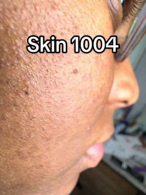 #SKIN1004NewArrivals #SKIN1004 #centella #dealsforyoudays #tiktokmademebuyit