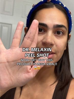 Not a want but a NEED, get yours below with free shipping and the huge discounted price before it ends!! 🌟💕🤩 #tiktokshopblackfriday #tiktokshopcreatorpicks #drmelaxinpeelshot #drmelaxin #exfoliate
