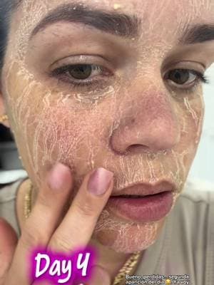 Day 4 zombie 🧟♀️ pack @SKIN1004 US #SKIN1004, #tiktokshopcreatorpicks, #koreanskincare, #centella, #skincare