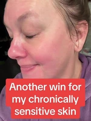 Skin barrier recovery at any age 💚 My chronically sensitive skin has never felt better thanks to the Anua 9-piece kit. #SkinBarrier #SensitiveSkin #ChronicIllnessFriendly #AnuaSkincare #tiktokshopholidayhaul