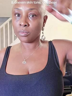 The axisy Dark Spot correcting serum and TXA 2.5% Intensive Brightening cream have been a great addition to my routine @AXISY UK #axisy #darkspotserum #brightskin #glowup #tiktokmademebuyit