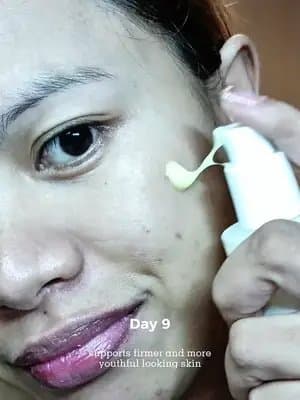 Part 30 ✨ My whole face was struggling—acne, dark spots, uneven tone. This serum changed everything 💧✨ 🧪 Key Ingredients: ✔️ 2% Retinal Liposome – reduces fine lines & boosts collagen ✔️ 58% Black Ginseng Extract – powerful antioxidant ✔️ Niacinamide – brightens and smooths skin tone ✔️ Bakuchiol – gentle retinol alternative ✔️ Peptides – supports skin repair & elasticity 🧴 How to Use: 🌙 At night – after cleansing, apply 1-2 pumps, massage gently, then seal with moisturizer. 🌞 In the morning – don’t forget sunscreen ha, very important pag gumagamit ng retinal! ⚠️ Disclaimer: 🚫 Do a patch test before full use 🚫 Bawal sa open wounds or broken skin 🚫 Start 2–3x a week kung sensitive skin ka 🌤️ Always wear sunscreen during the day! ✨ Visible results in just a few weeks – glow up ang peg! 🛒 Where to buy: Amazon, Yesstyle, Stylevana, Stylekorean @KSECRET GLOBAL #glowupwithretinalchallenge #ksecret #seoul1988 #RetinalSerum #AntiAgingSkincare #KSecretSeoul1988 #KoreanSkincarePH #GlowingSkinTips #TikTokMadeMeBuyIt #PeptideSerum #RetinolAlternative #KBeautyFinds
