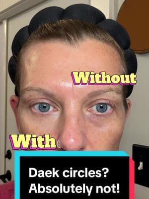 Dark circles were literally ruining my makeup until I tried this 😭 This @tarte cosmetics Colored Clay CC Undereye Corrector brightens, color corrects, smooths fine lines, and makes concealer look SO much better without creasing or looking cakey. If you struggle with tired eyes, mature skin, textured under eyes, or concealer separating by lunchtime… this is the makeup hack you need. Perfect for busy moms, exhausted girls, and anyone wanting bright flawless under eyes ✨ #tiktokshopmemorialday #summervibes #dealsforyoudays #weeklydeals
