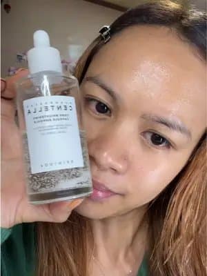 Irritation again? Calm it fast! #GoViralWithSKIN1004Challenge #SKIN1004White #skin1004 #centella #TikTokMadeMeBuyIt @skin1004_challenge @SKIN1004 US