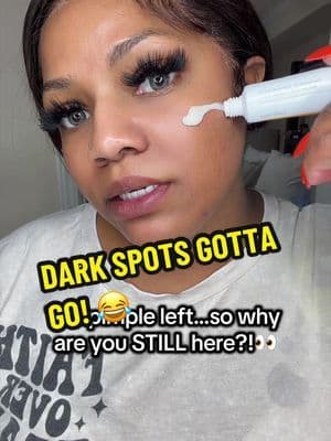 The breakout left, but the dark spot stayed! ๐ญ๐ Working toward a brighter, more even-looking complexion. #darkspotcare #niacinamide #hyperpigmentation #tiktokshopblackfriday #discoveryourgift @celimax.global