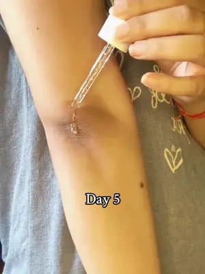 Wrinkly, dark elbows? 🌸 Skin1004 Tone Brightening Capsule Ampoule to the rescue. #goviralwithskin1004challenge #skin1004white #centella #tiktokmademebuyit #kbeauty @SKIN1004 US @skin1004_influencers