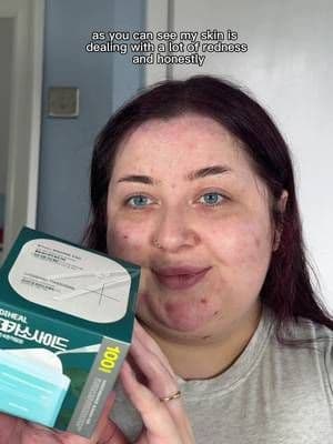 These are some Amazon Prime Day must haves!! @MEDIHEAL_UK Madecassoside Blemish Pads are a total skin saver for me right now 🤍 #mediheal #tonerpad #glowyskin #amazonfinds