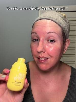 Will this actually fade my acne marks? 👀 I’ve seen this @Bubble Skincare serum everywhere, so it was finally time to pu