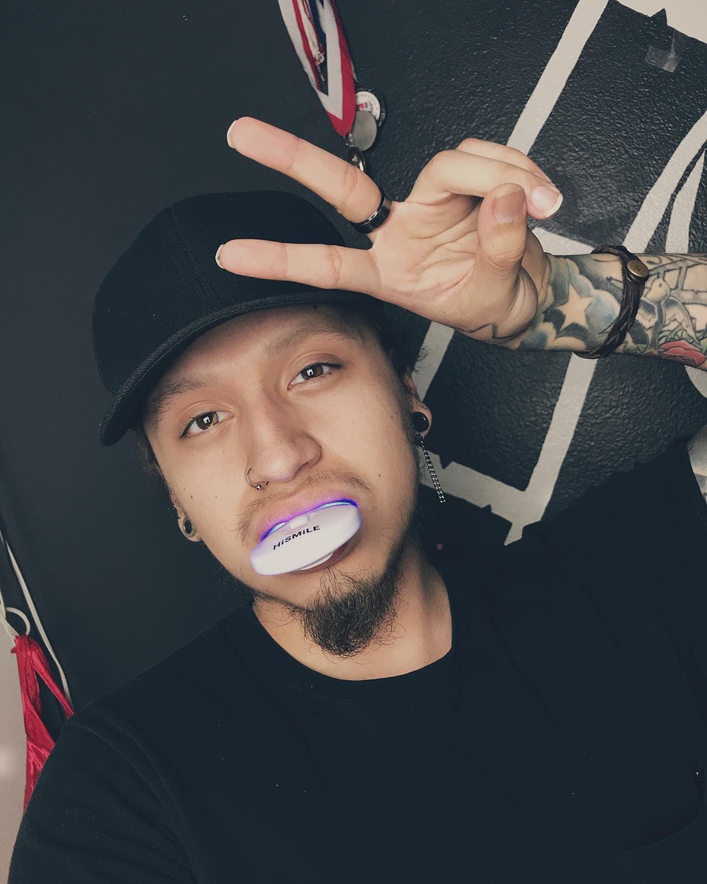 Was great experience, I truly recommend this item if you have done so , @hismileteeth , go get it !!! You won’t regret t