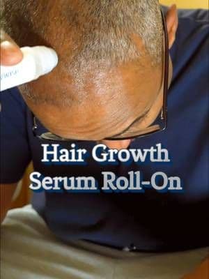 Is your hair thining out? @RootLabs #creatorsearchinsights #tiktokshopjumpstartsale #tiktokshopcreatorpicks #bodywisehairgrowthserum #ttstoptier