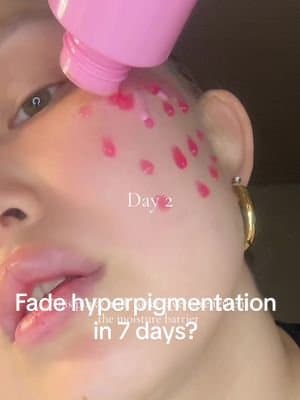Thank you to my one and only @APRILSKIN USA for getting rid of my hyperpigmentation 🌸🫶🏻💝 I have used APRILSKIN Spicy Jelly Serum & Glazed Creamy Toner for a week and couldn’t be more fascinated by results! #APRILSKIN #spicyjellyserum #glazedcreamytoner #hyperpigmentation #darkspot #pores #glassskin #skintok #tiktokshopnewarrivals #APRILSKINskincare #sephora #ulta