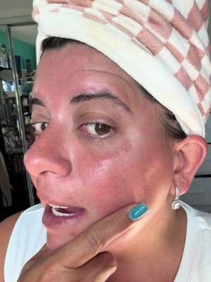 @ROC line smoothing pads have surprised me. #dealsforyoudays #ttsbeautybesties #tiktokshopstockup #antiaging