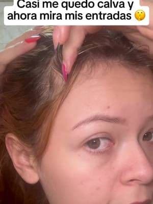 Raíz fuerte, pelo feliz 💖 Con Be Bodywise no necesitas complicarte, solo roll on y listo 😍 #HairRoutine #caidadecabello #CabelloLargo #tiktokshoprestock #HairCareTips