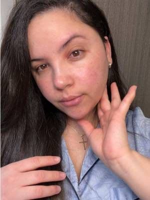 4/10 Azelaic acia de @SKIN1004 US @skin1004_official #skin1004 #koreanskincare #azelaicacid #acneproneskin #tiktokshopcreatorpicks